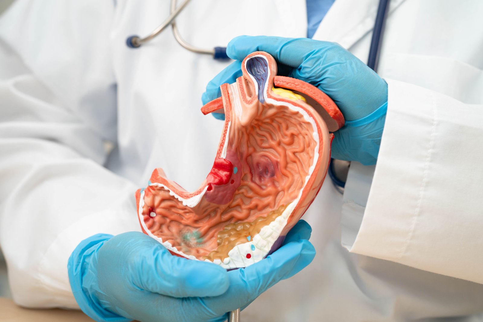 GASTROENTEROLOGY – UPPER GI ENDOSCOPY