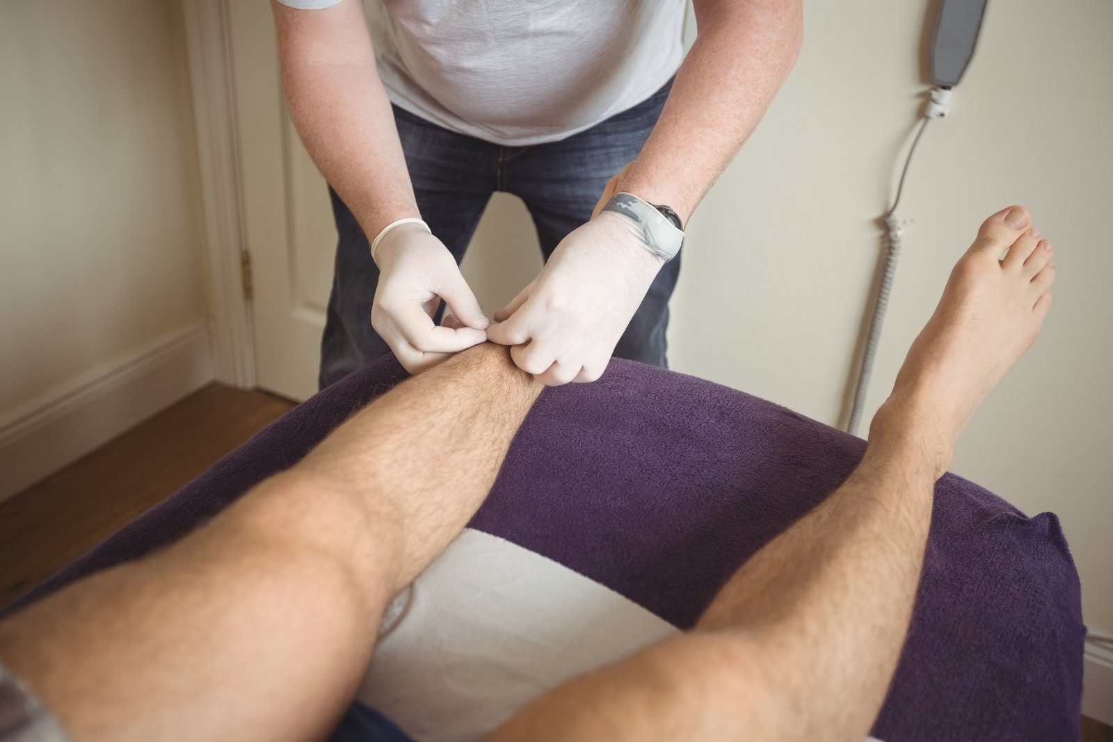 VARICOSE VEINS TREATMENT