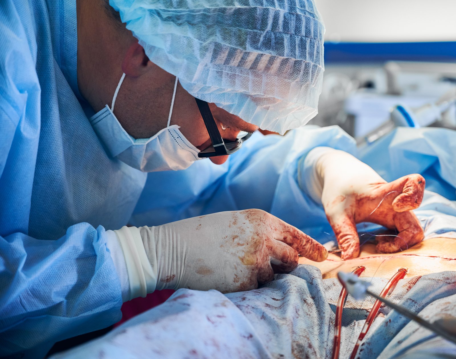 VASCULAR SURGERY